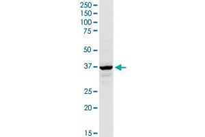 AACS MaxPab rabbit polyclonal antibody. (AACS 抗体  (AA 1-410))