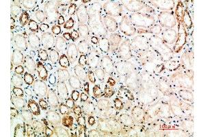 Immunohistochemical analysis of paraffin-embedded human-kidney, antibody was diluted at 1:200 (CTLA4 抗体  (AA 41-90))