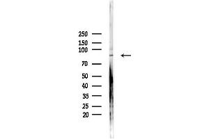 anti-Enoyl-CoA, Hydratase/3-Hydroxyacyl CoA Dehydrogenase (EHHADH) (Internal Region) antibody