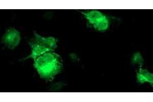 Anti-FBXO21 mouse monoclonal antibody (ABIN2455305) immunofluorescent staining of COS7 cells transiently transfected by pCMV6-ENTRY FBXO21 (RC223095). (FBXO21 抗体)