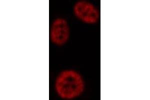 ABIN6276948 staining HepG2? (PAD4 抗体  (N-Term))