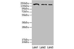 Western blot All lanes: CLTCL1 antibody at 2 μg/mL Lane 1: Jurkat whole cell lysate Lane 2: NIH/3T3 whole cell lysate Lane 3: A431 whole cell lysate Secondary Goat polyclonal to rabbit IgG at 1/10000 dilution Predicted band size: 188, 181 kDa Observed band size: 188 kDa (CLTCL1 抗体  (AA 1423-1566))