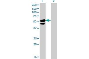 Western Blot analysis of AAK1 expression in transfected 293T cell line by AAK1 monoclonal antibody (M02), clone 4B10. (AAK1 抗体  (AA 315-415))