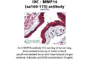 Image no. 1 for anti-Matrix Metallopeptidase 14 (Membrane-inserted) (MMP14) (AA 160-173) antibody (ABIN2852383) (MMP14 抗体  (AA 160-173))