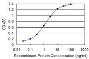 Detection limit for recombinant GST tagged TKTL2 is 0. (TKTL2 抗体  (AA 59-120))