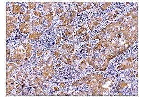 IHC analysis of DHPS/DHS using anti-DHPS/DHS antibody (ABIN7601998). (DHPS 抗体  (AA 54-358))