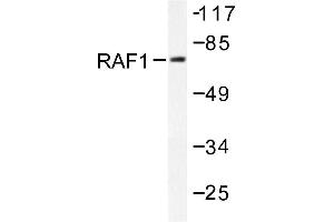 Image no. 1 for anti-V-Raf-1 Murine Leukemia Viral Oncogene Homolog 1 (RAF1) antibody (ABIN271937) (RAF1 抗体)