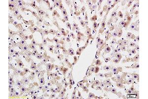Formalin-fixed and paraffin embedded rat colitis labeled with Anti COLEC10(LIVER) Polyclonal Antibody, Unconjugated (ABIN872637) at 1:200 followed by conjugation to the secondary antibody and DAB staining