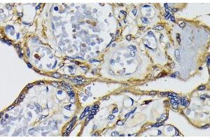 Immunohistochemistry of paraffin-embedded Human placenta using IQGAP1 Polyclonal Antibody at dilution of 1:200 (40x lens). (IQGAP1 抗体)