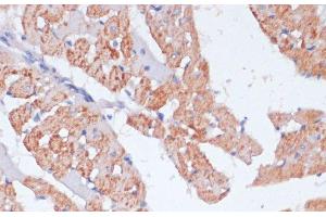 Immunohistochemistry of paraffin-embedded Rat heart using ARRB1 Polyclonal Antibody at dilution of 1:100 (40x lens). (beta Arrestin 1 抗体)