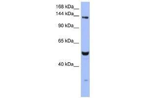 WB Suggested Anti-MSH6 Antibody Titration:  0. (MSH6 抗体  (N-Term))