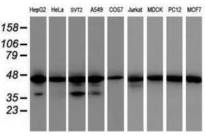 Image no. 1 for anti-Isocitrate Dehydrogenase 1 (NADP+), Soluble (IDH1) antibody (ABIN1502107) (IDH1 抗体)