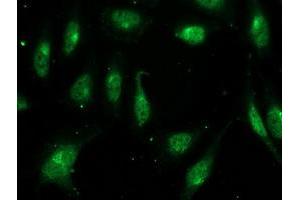 Immunofluorescent staining of HeLa cells using anti-FGF21 mouse monoclonal antibody (ABIN2454474). (FGF21 抗体  (AA 29-209))