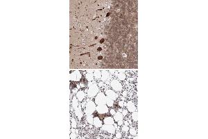 Immunohistochemical staining of human bone marrow with KIF4A polyclonal antibody  shows strong nuclear positivity in hematopoietic cells at 1:50-1:200 dilution. (KIF4A 抗体)