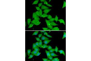 Immunofluorescence analysis of U20S cell using STK3 antibody. (STK3 抗体)