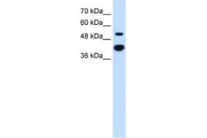 Western Blotting (WB) image for anti-Matrix Metallopeptidase 1 (Interstitial Collagenase) (MMP1) antibody (ABIN2462518) (MMP1 抗体)