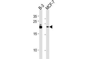 Western Blotting (WB) image for anti-Chromosome 13 Open Reading Frame 30 (C13orf30) antibody (ABIN3004687) (C13orf30 抗体)