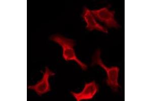 ABIN6276906 staining HuvEc by IF/ICC. (IL-10RA 抗体  (C-Term))