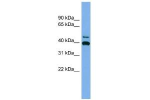 WB Suggested Anti-FGL2 Antibody Titration: 0.