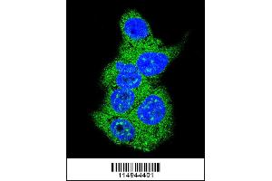 Confocal immunofluorescent analysis of Aldolase (ALDOA) Antibody with HepG2 cell followed by Alexa Fluor 488-conjugated goat anti-rabbit lgG (green). (Aldolase 抗体  (N-Term))