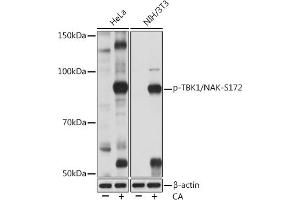 Western blot analysis of extracts of various cell lines, using Phospho-TBK1/NAK-S172 Rabbit mAb (ABIN7270721) at 1:1000 dilution. (TBK1 抗体  (pSer172))