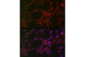 Immunofluorescence (IF) image for anti-Actin Related Protein 2/3 Complex, Subunit 2, 34kDa (ARPC2) antibody (ABIN7265385)