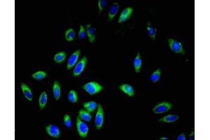 Immunofluorescent analysis of A549 cells using ABIN7163589 at dilution of 1:100 and Alexa Fluor 488-congugated AffiniPure Goat Anti-Rabbit IgG(H+L) (CD42a 抗体  (AA 17-88))