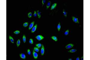 Immunofluorescent analysis of A549 cells using ABIN7163589 at dilution of 1:100 and Alexa Fluor 488-congugated AffiniPure Goat Anti-Rabbit IgG(H+L) (CD42a 抗体  (AA 17-88))