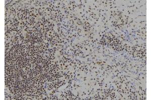 ABIN6278307 at 1/100 staining Human spleen tissue by IHC-P.