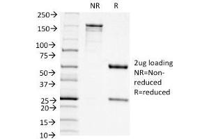 SDS-PAGE Analysis Purified CD11c Mouse Monoclonal Antibody (ITGAX/1242). (CD11c 抗体  (AA 637-827))