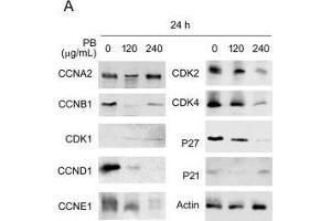 Western Blotting (WB) image for anti-Cyclin-Dependent Kinase 4 (CDK4) antibody (ABIN2855529)