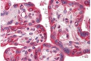 Human Placenta (formalin-fixed, paraffin-embedded) stained with SKIL antibody ABIN214478 at 2. (SKIL 抗体  (N-Term))