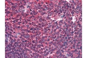 Human Tonsil: Formalin-Fixed, Paraffin-Embedded (FFPE) (BIRC3 抗体)