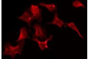 ABIN6275585 staining HuvEc by IF/ICC. (SLC5A3 抗体)