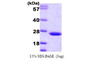SDS-PAGE (SDS) image for Flavin Reductase (BLVRB) (AA 1-206) protein (ABIN666868) (BLVRB Protein (AA 1-206))