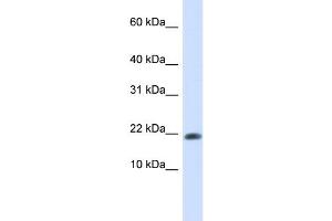 WB Suggested Anti-GABARAPL2 Antibody Titration: 0. (GABARAPL2 抗体  (N-Term))
