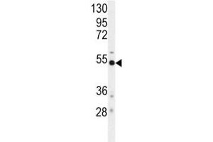Western blot analysis of BACE antibody and mouse cerebellum tissue lysate. (BACE1 抗体  (AA 476-501))