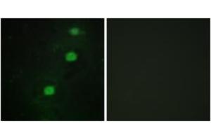 Immunofluorescence analysis of HuvEc cells, using CCRK Antibody. (CCRK 抗体  (AA 31-80))