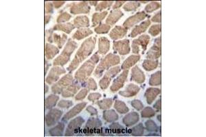 Hamartin (TSC1) Antibody (Center) (ABIN652207 and ABIN2840760) immunohistochemistry analysis in formalin fixed and paraffin embedded human skeletal muscle followed by peroxidase conjugation of the secondary antibody and DAB staining. (TSC1 抗体  (AA 401-430))