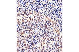 Immunohistochemical analysis of paraffin-embedded H. (CSE1L 抗体  (N-Term))