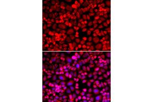 Immunofluorescence analysis of A549 cells using ANLN antibody (ABIN5973909). (Anillin 抗体)