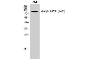 Western Blotting (WB) image for anti-Heat Shock Protein 90 (HSP90) (acLys435) antibody (ABIN3181887) (HSP90 抗体  (acLys435))
