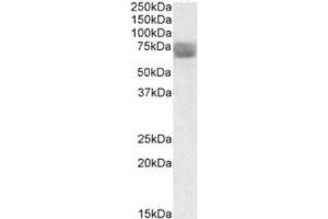 Western Blotting (WB) image for anti-Tripeptidyl Peptidase I (TPP1) (Internal Region) antibody (ABIN2464251) (TPP1 抗体  (Internal Region))
