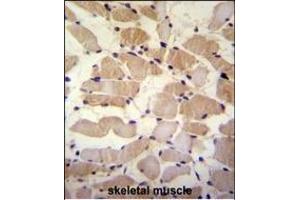 SUSD5 Antibody (C-term) (ABIN655447 and ABIN2844977) immunohistochemistry analysis in formalin fixed and paraffin embedded human skeletal muscle followed by peroxidase conjugation of the secondary antibody and DAB staining. (SUSD5 抗体  (C-Term))