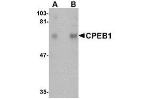 Image no. 1 for anti-Cytoplasmic Polyadenylation Element Binding Protein 1 (CPEB1) (N-Term) antibody (ABIN342681) (CPEB1 抗体  (N-Term))