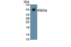 Detection of Recombinant CGRP, Mouse using Polyclonal Antibody to Calcitonin Gene Related Peptide (CGRP) (CGRP 抗体  (AA 1-130))