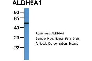Western Blotting (WB) image for anti-Aldehyde Dehydrogenase 9 Family, Member A1 (ALDH9A1) (C-Term) antibody (ABIN2788130)