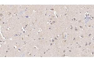 Detection of FGF13 in Human Cerebrum Tissue using Monoclonal Antibody to Fibroblast Growth Factor 13 (FGF13) (FGF13 抗体  (AA 108-227))