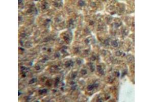 #VALUE! (Lacritin 抗体  (AA 20-138))