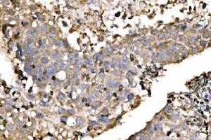 IHC analysis of EVL using anti-EVL antibody (ABIN7600986). (EVL 抗体  (AA 268-400))